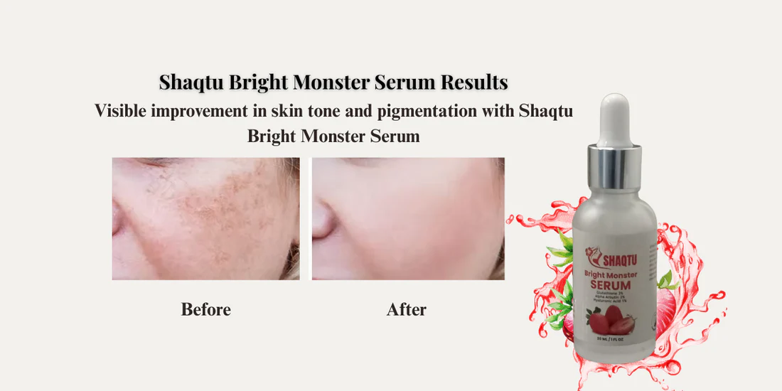 Reduce Dark Spots & Pigmentation Effectively