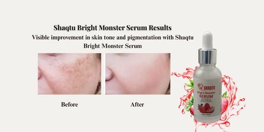 Reduce Dark Spots & Pigmentation Effectively